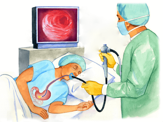 gastroscopy 1